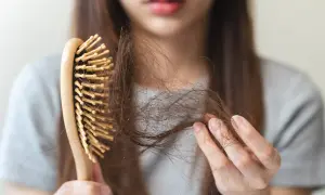 Une femme examine sa brosse à cheveux, remplie de mèches, signe de cheveux cassants.