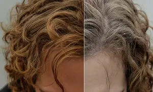 Cheveux gonflés avant et après traitement. La partie gauche montre des cheveux bruns et bouclés, la partie droite des cheveux plus fins et gris.
