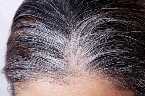 Cheveux bruns et blancs, prêts pour le temps de pose henné. La repousse grise se mêle aux mèches foncées.