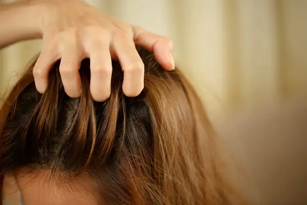 Main qui se gratte le cuir chevelu, une question que l'on se pose : pourquoi mes cheveux graissent vite ?